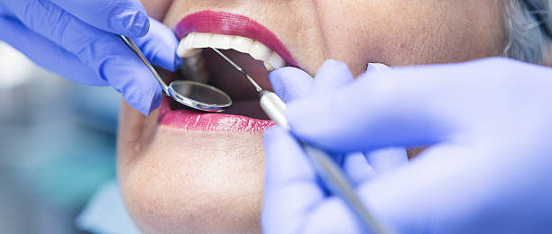 Best Emergency Dentist for Knocked-Out Tooth in Wellington, CO